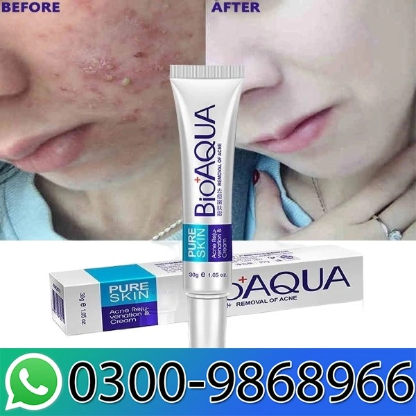 Bioaqua Pure Skin Acne Rejuvenation Cream In Pakistan
