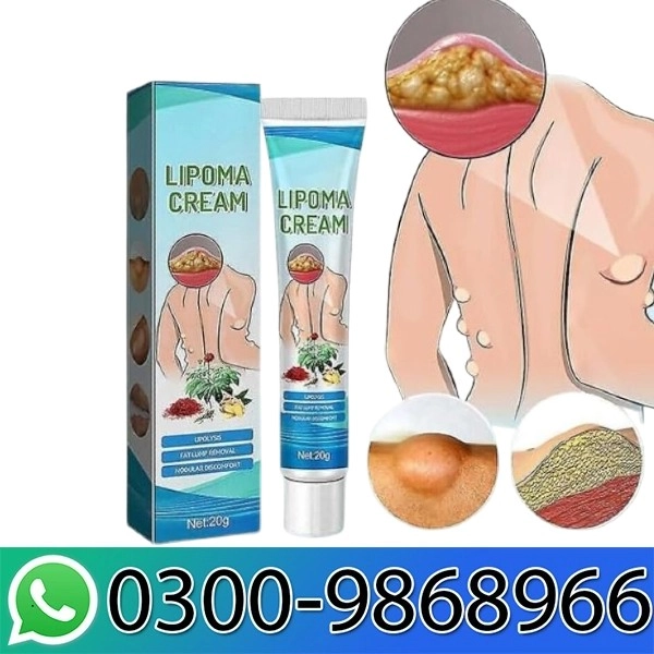 South Moon Lipoma Cream In Pakistan