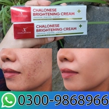 Chalonese Brightening Cream in Pakistan