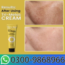 Dr Romia Tri Melas Melasma Cream In Pakistan